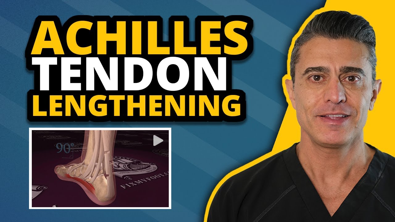 Achilles Tendon Lengthening Explained