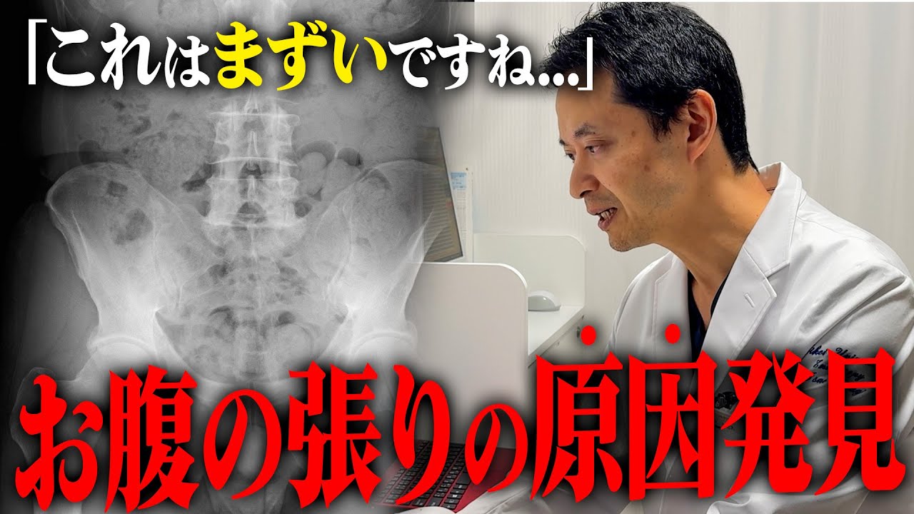 原因がわかりづらいお腹の張り...その原因は何があるのか？現役医師が解説！