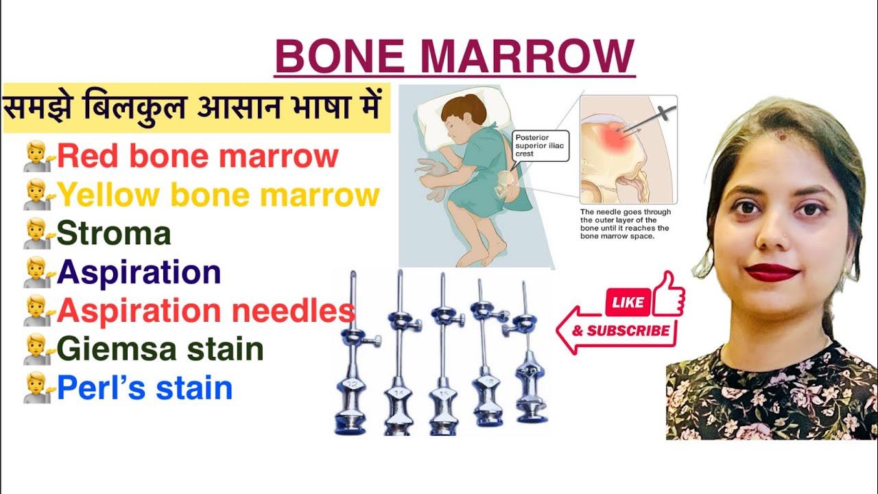 Bone marrow in Hindi | Aspiration | Aspiration Needles | Perl’s Stain | Red & Yellow bone marrow