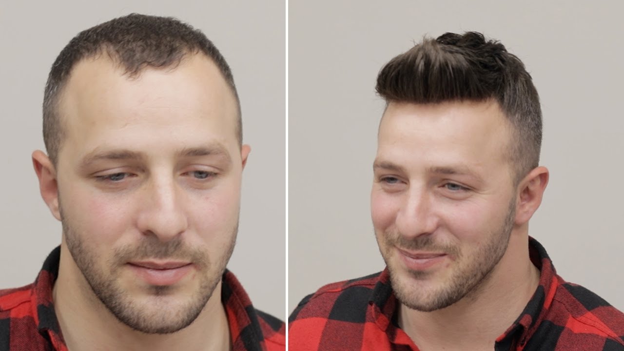 PROTEZ SAÇ NASIL YAPILIR - Hair Replacement