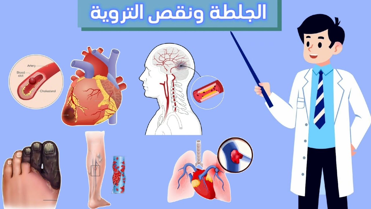 تجلط الدم و سر الوقاية منه  والاحتفاظ بصحة جيدة .