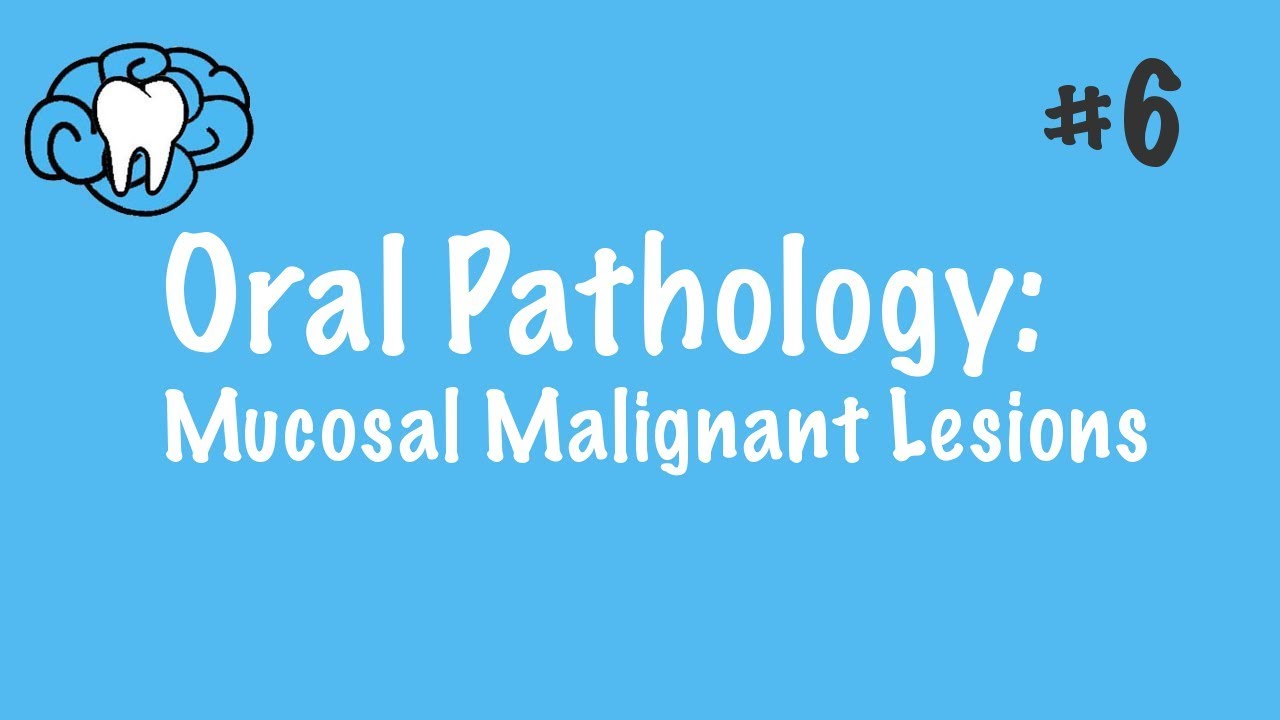 Oral Pathology | Mucosal Malignant Lesions | INBDE, ADAT