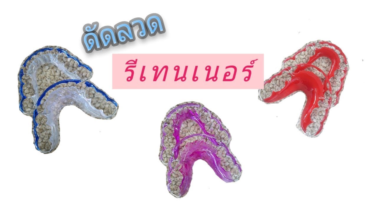 รีเทนเนอร์ (Retainer) ดัดลวดทำรีเทนเรอร์