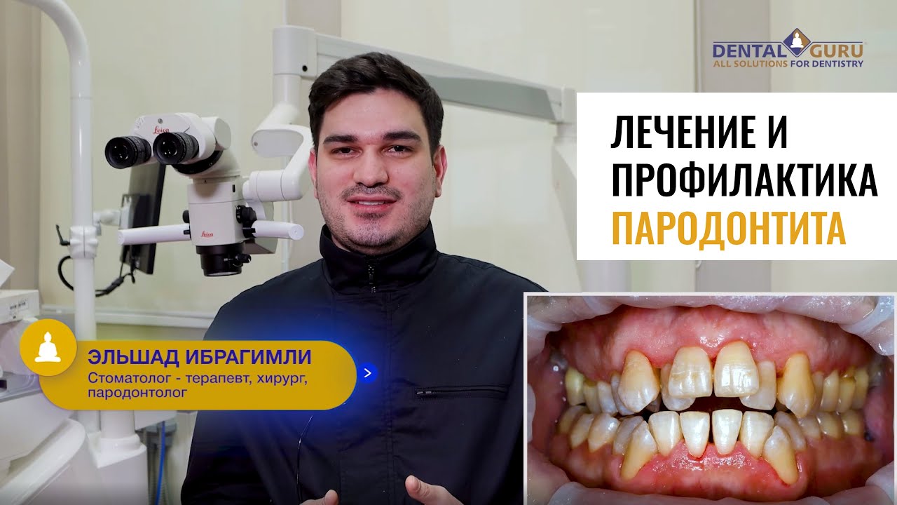 Лечение и профилактика пародонтита