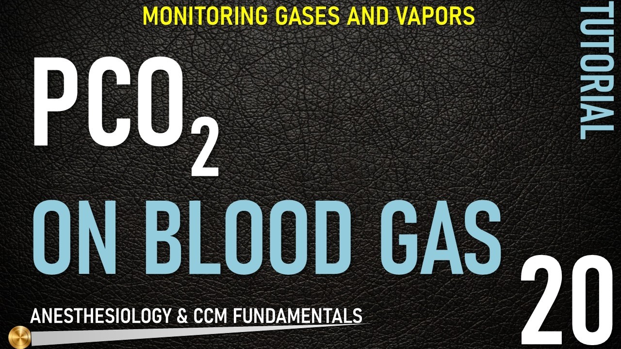 Blood Gas Machines pH, PCO2 and Sampling (tips and tricks)