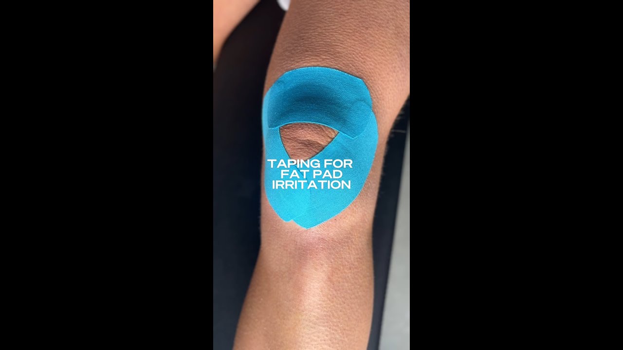 Taping for Fat Pad Irritation