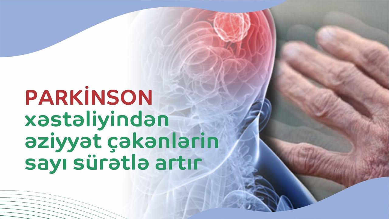 Parkinson xəstəliyinin erkən əlamətləri və simptomları - Nəyə diqqət etməliyik?-Nevroloq açıqlaması