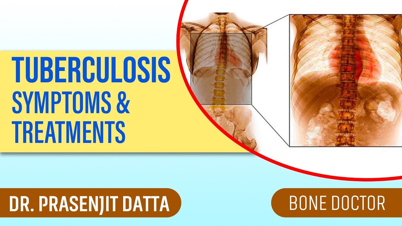 Tuberculosis in Bone & Joints - causes, symptoms, diagnosis, treatment