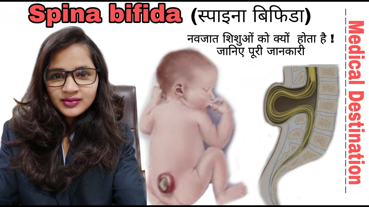 Spina bifida | types | cause | symptoms | diagnosis & treatment in  hindi | medical Destination |