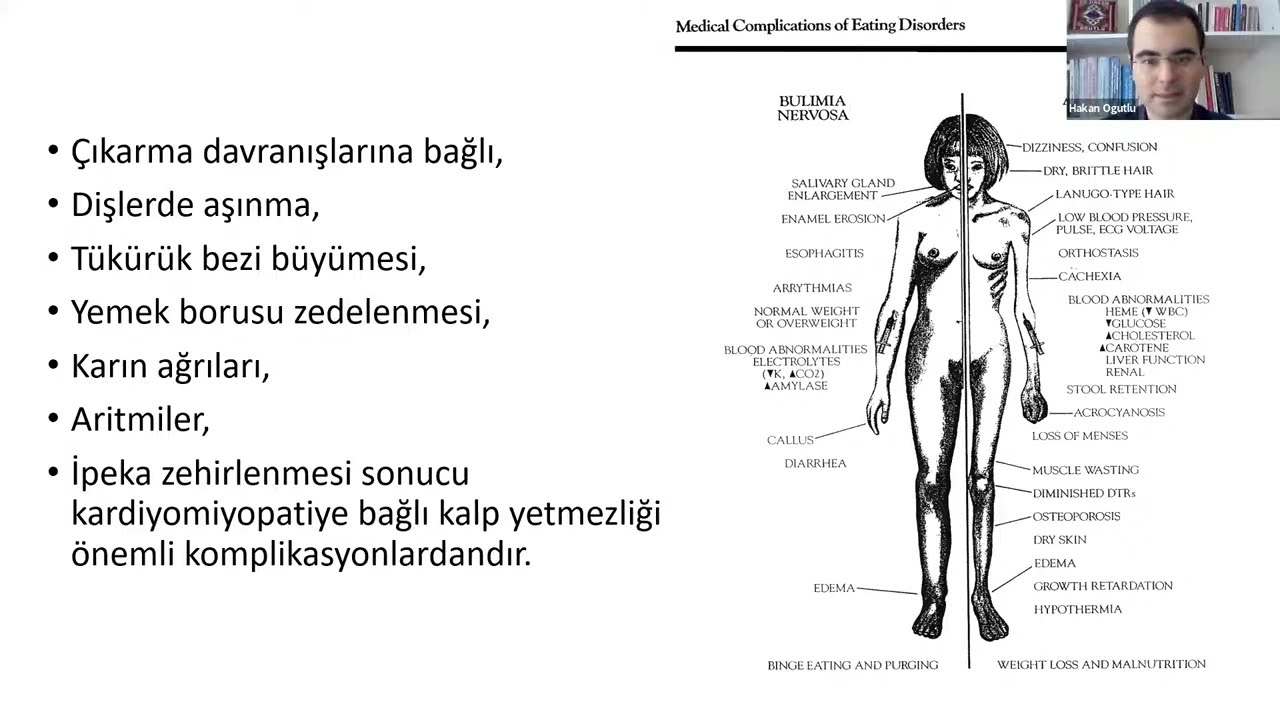 Çocuk ve Ergenlerde Yeme Bozuklukları İçin Bilişsel Davranışçı Terapi