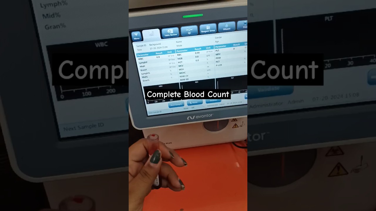 CBC ll Complete Blood Count 🩸 ll #complete #bloodcount #sortavideo  #cbc #bloodtest #vial #lab