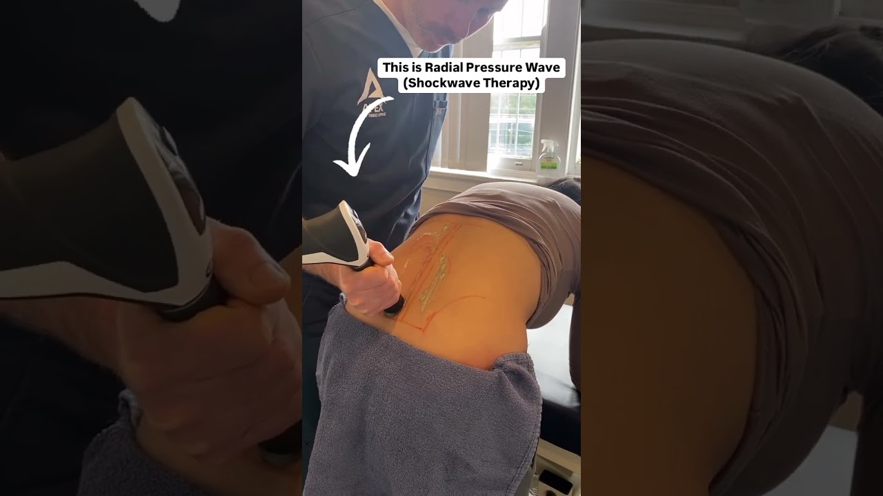 Chronic Lower Back & Hip Pain, treated with Radial Pressure Wave (Shockwave Therapy)