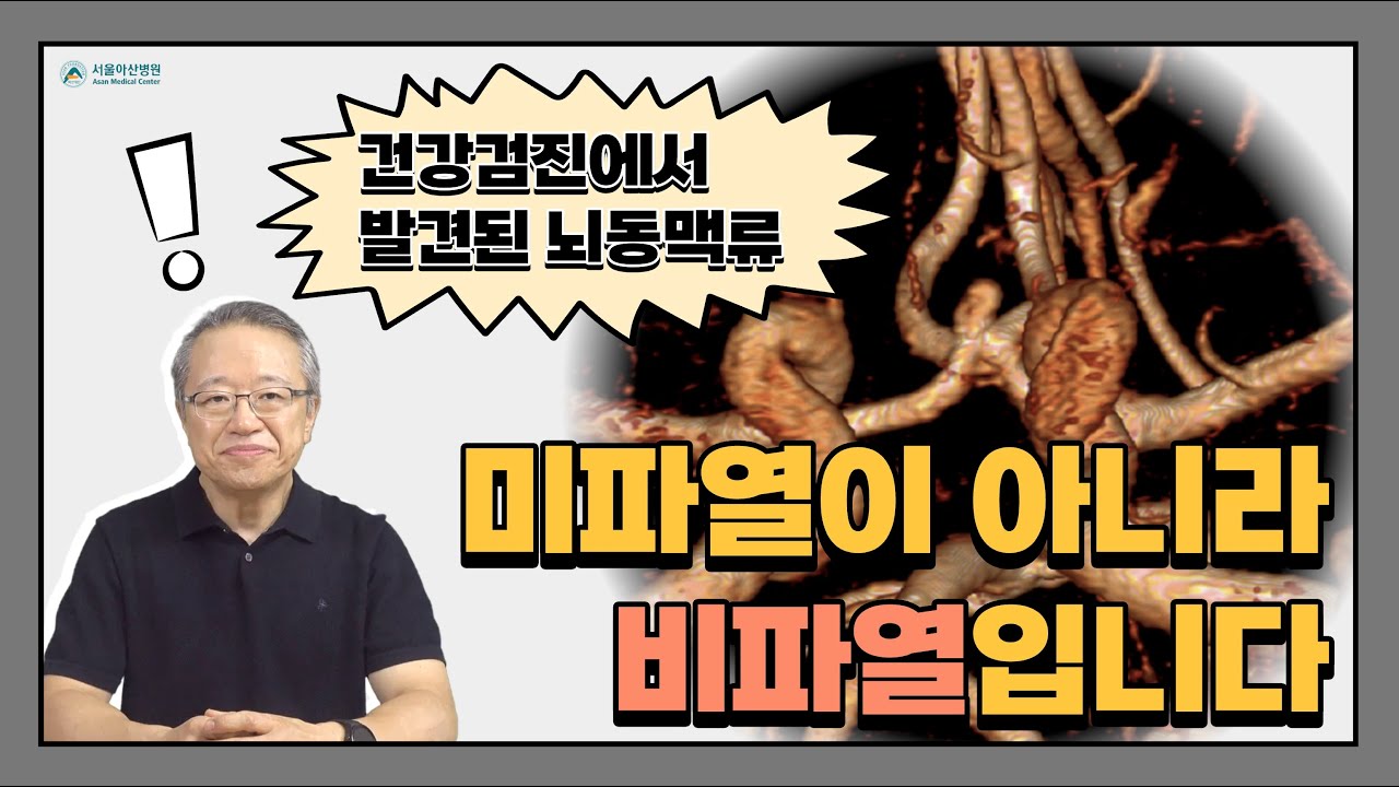 [뇌동맥류] 검진에서 발견된 뇌동맥류, 미파열이 아니라 비파열 입니다. 서울아산병원 영상의학과 이덕희 교수