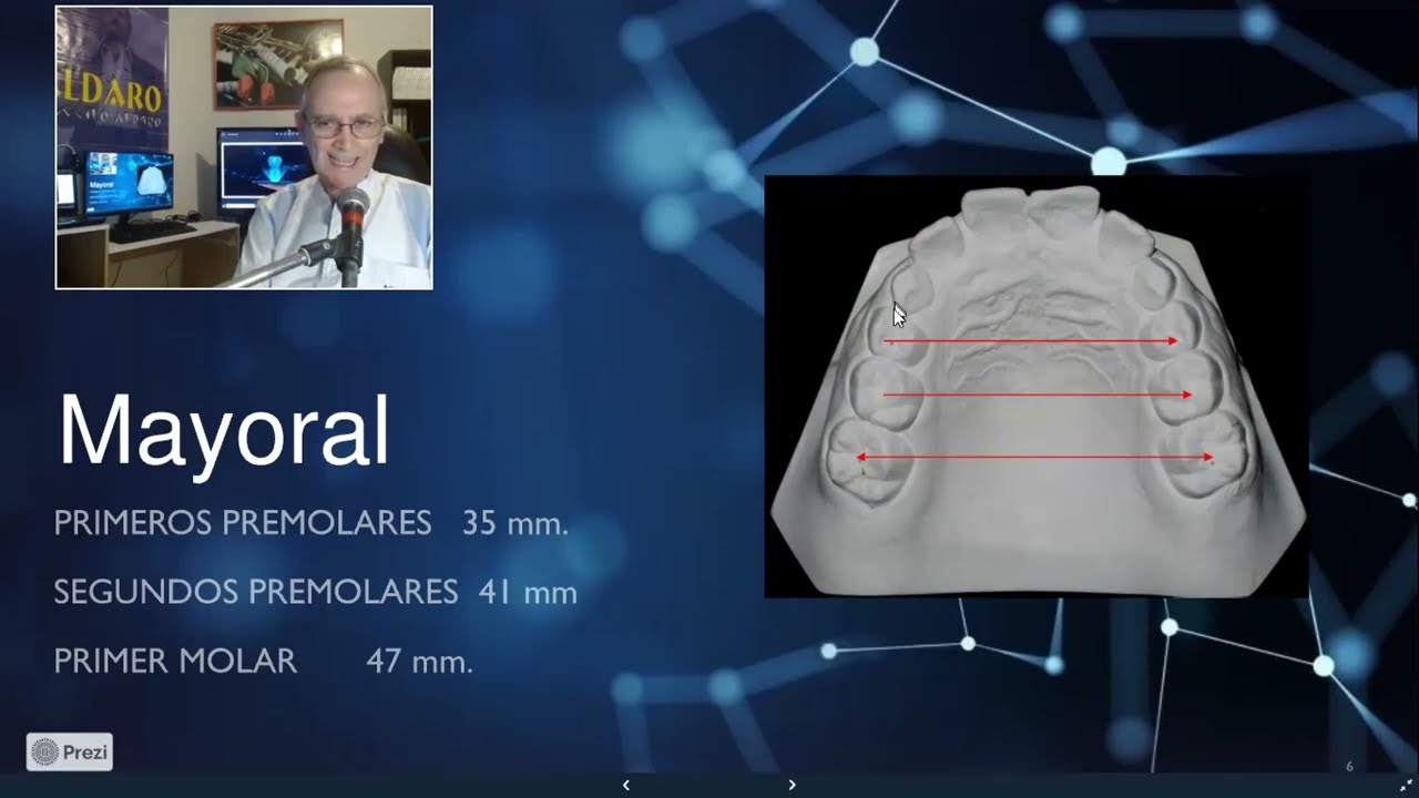 Análisis transversal de los Maxilares. Taller N° 8.  ANÁLISIS DENTAL. CCHAPRRO.
