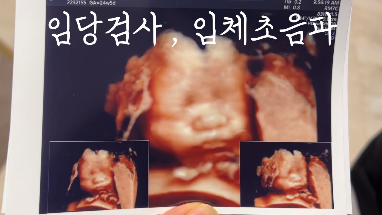 공포의 임당검사 / 귀염뽀짝 입체초음파 / 우리가족 사랑해요