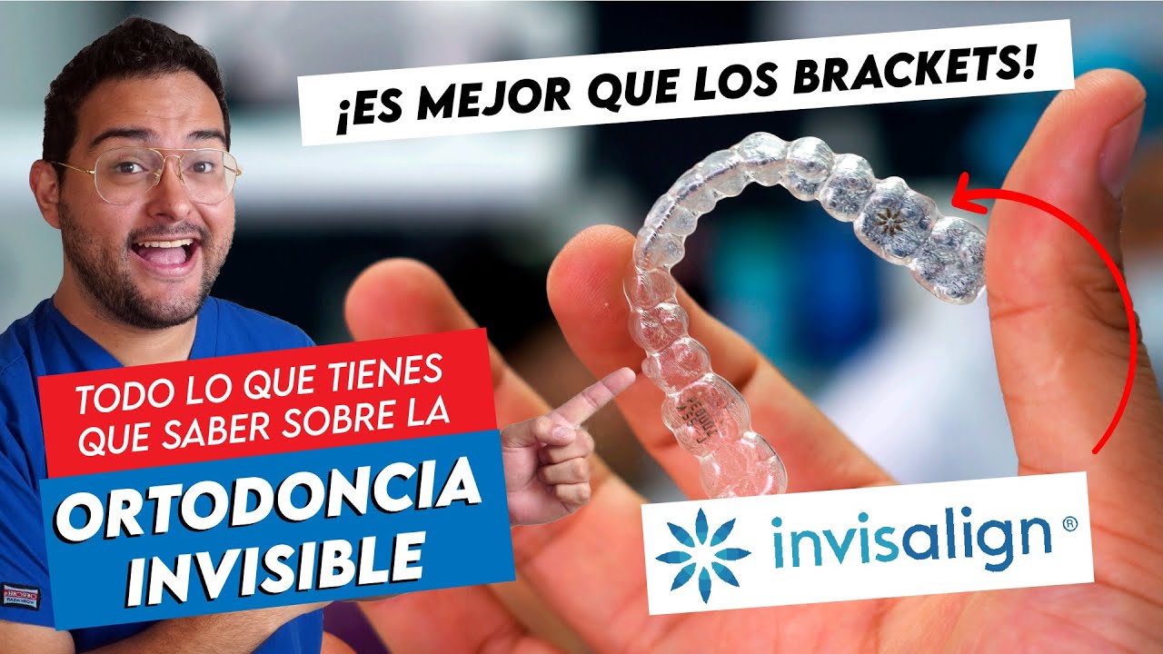 INVISALIGN: ORTODONCIA INVISIBLE CON GUARDAS Y ALINEADORES DENTALES en 2020 🔥