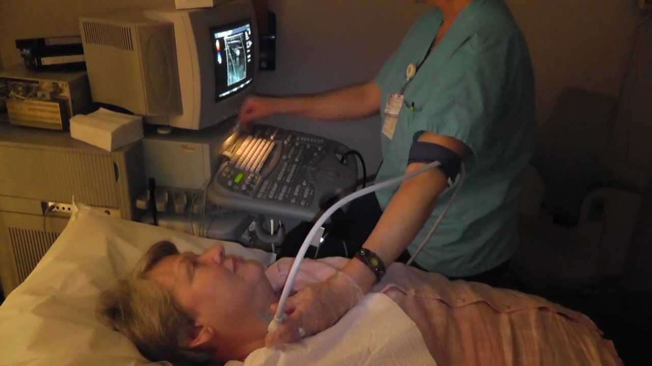 Ask ADC: Carotid Ultrasound