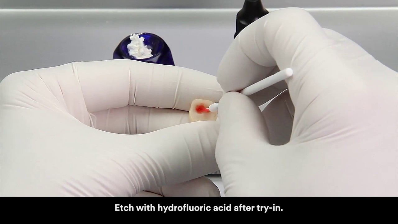 RelyX Ultimate clicker cementation of glass ceramic crown with tack cure technique