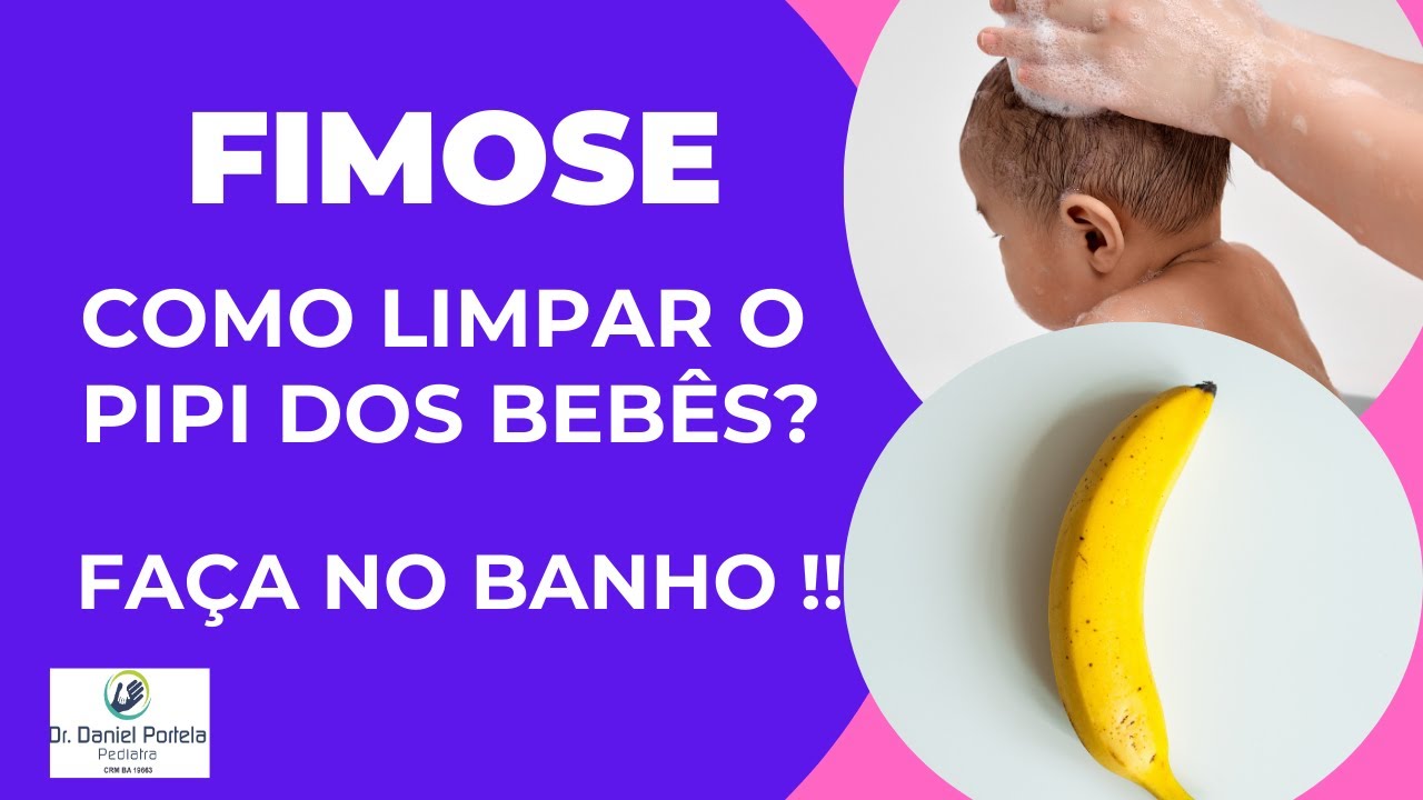 Fimose em recém nascido e bebês pequenos COMO limpar o pipi