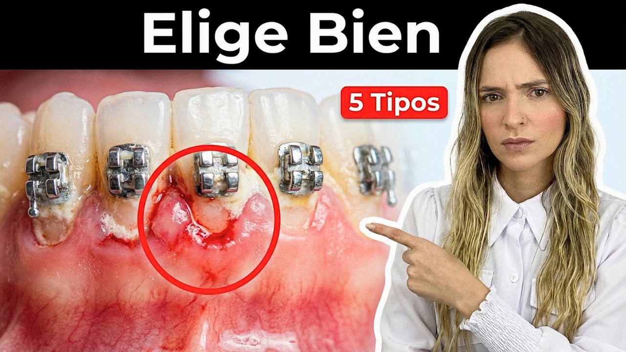 Los 5 Tipos De Aparato Más Usados: Cuál Elegir Y Cómo Decidir Rápido