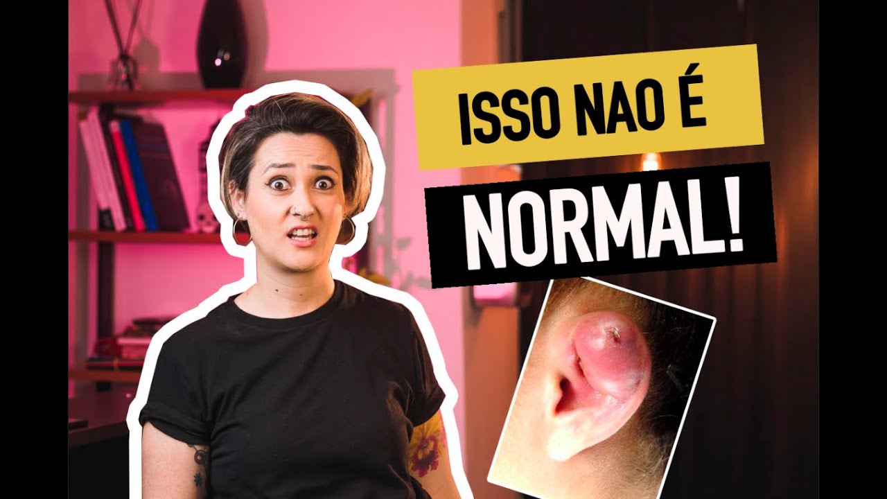 O que é NORMAL e o que é PERIGOSO durante a CICATRIZAÇÃO de PIERCING