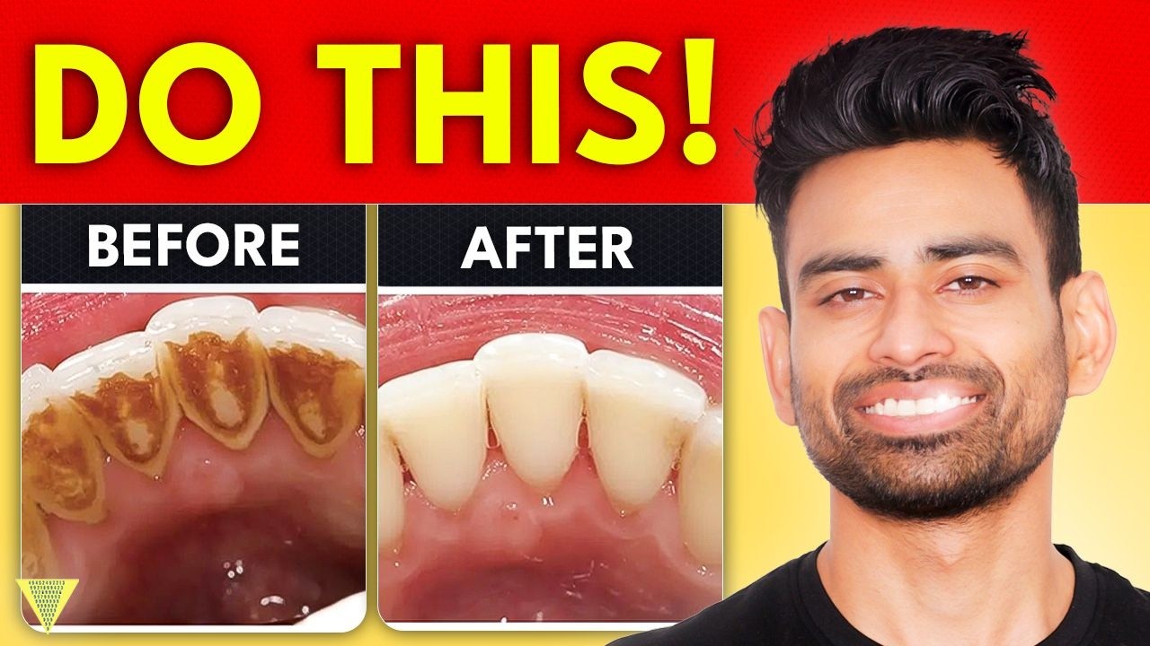 How to Remove Dental Plaque & Prevent Cavities?