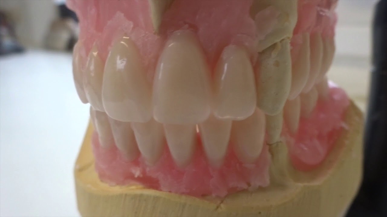 Creating a Denture Try-in