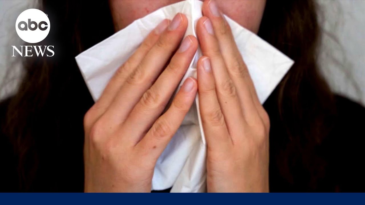 CDC: 29 states report 'high' or 'very high' flu activity as cases surge nationwide