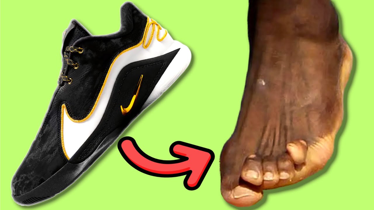 Foot Doctor Explains If LeBron's Nikes Are Causing His Bunion And Hammertoes