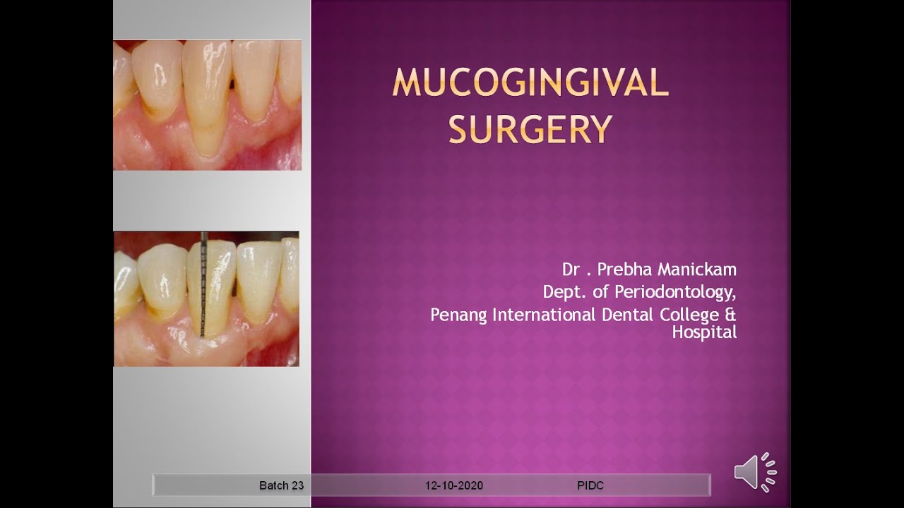 MUCOGINGIVAL SURGERY