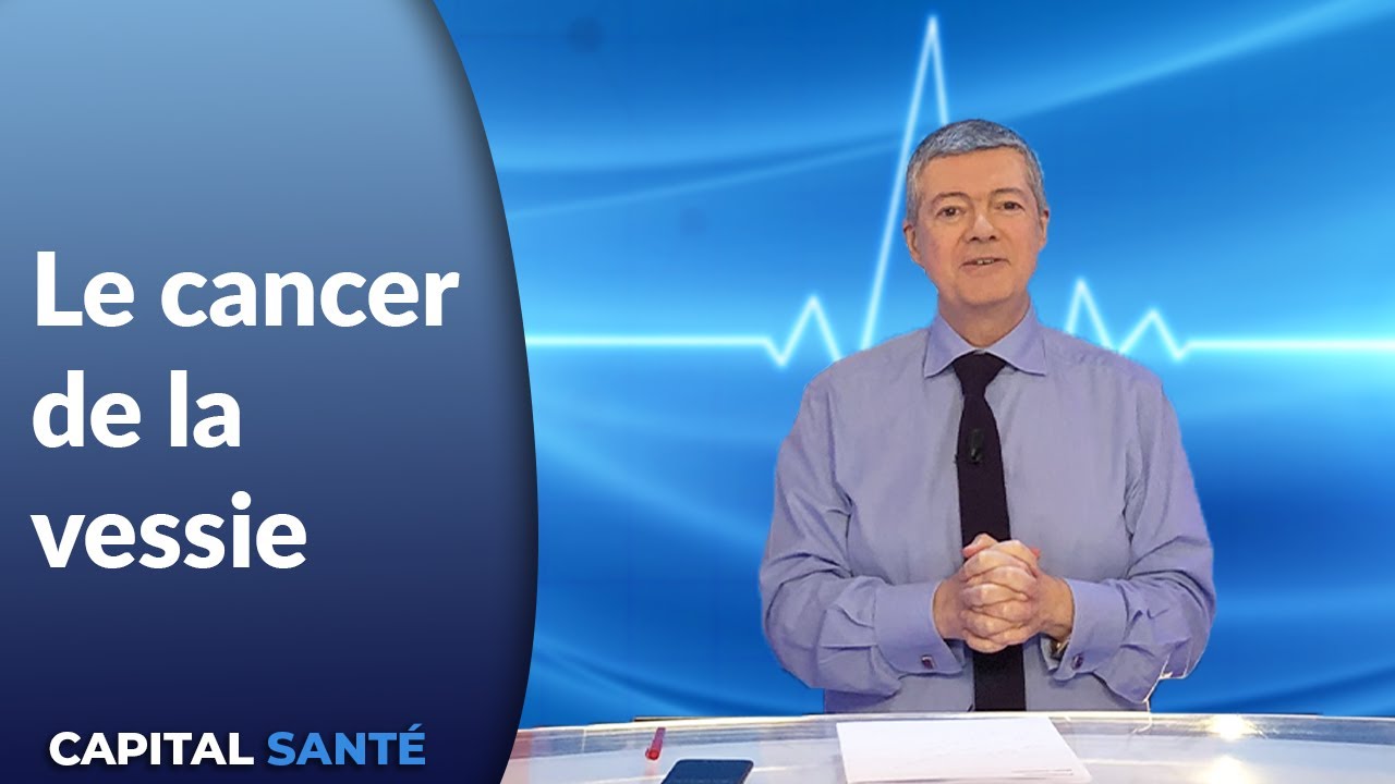 Le cancer de la vessie