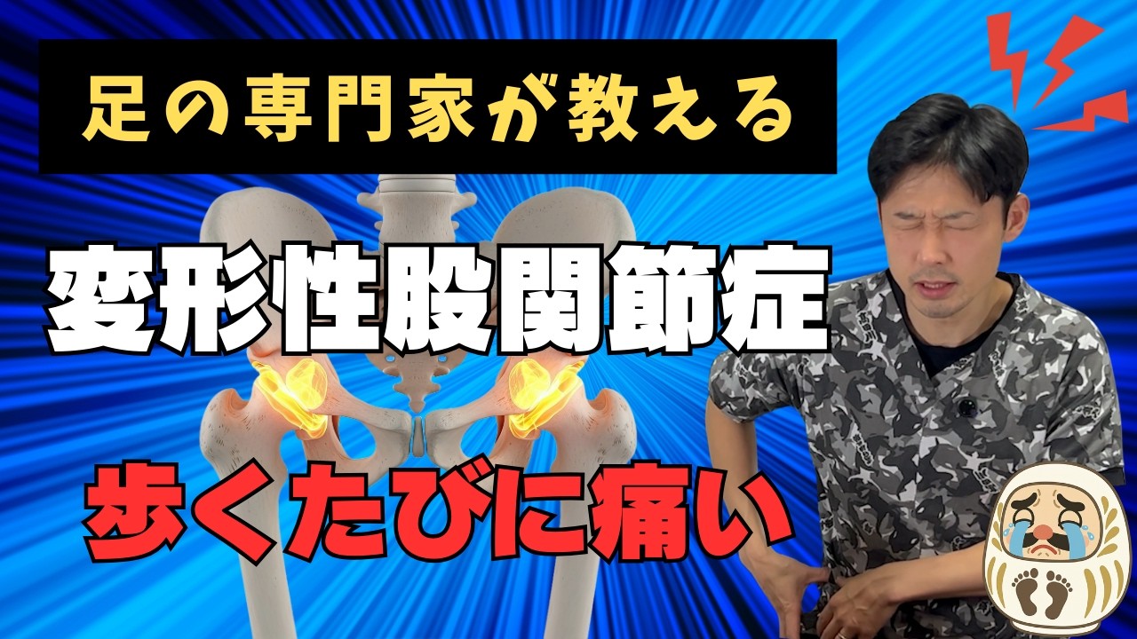 【歩くたびに痛い】変形性股関節症の症状・原因・改善法を全部まとめました！