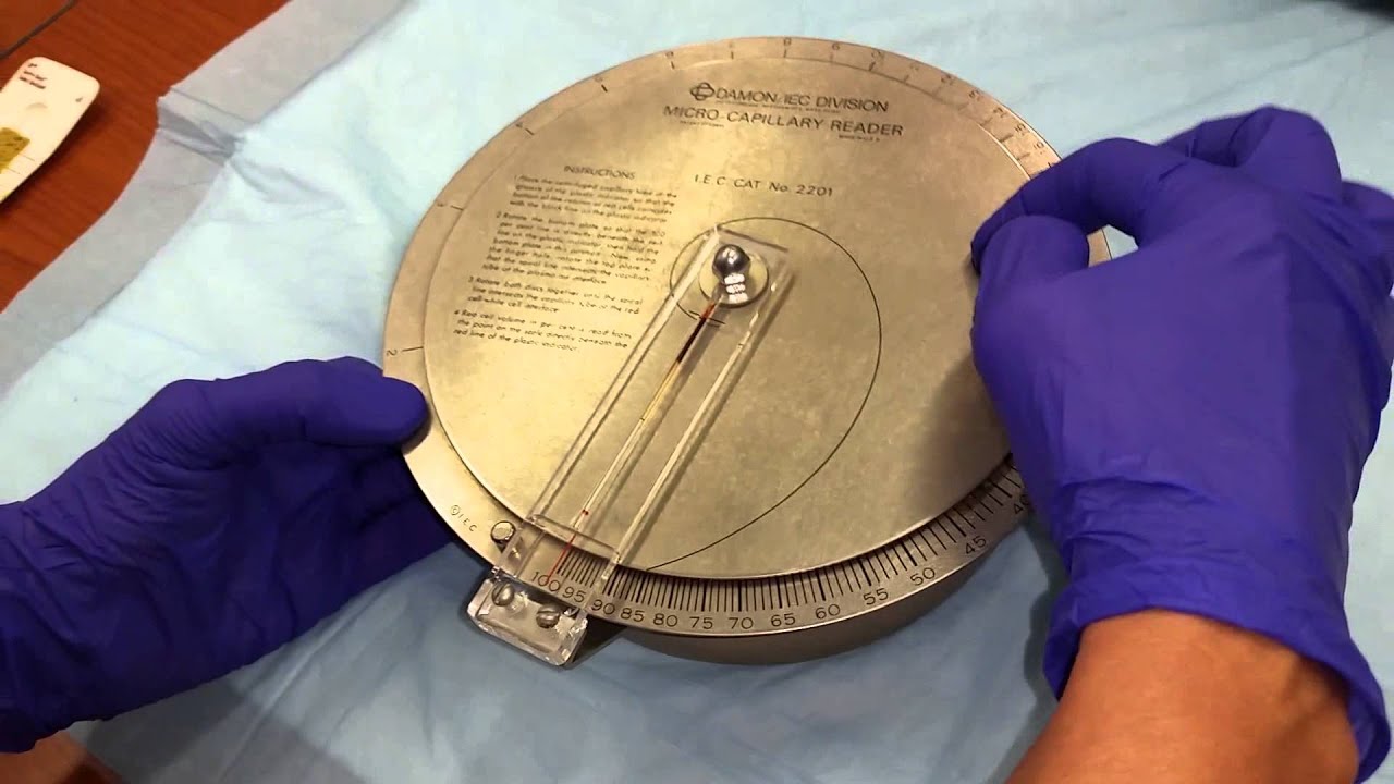 Measuring Microhematocrit