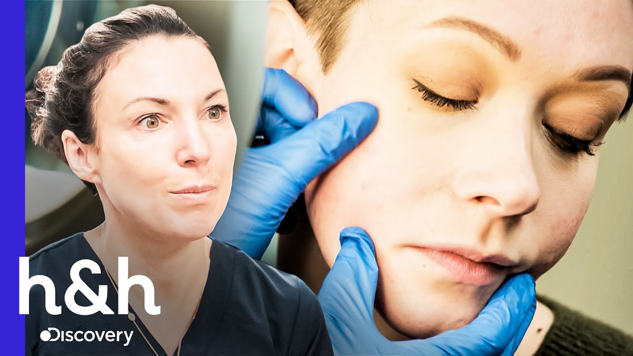 Paciente tem rosácea e fica com rosto muito inflamado | Dra. Emma: Uma Questão de Pele | H&H Brasil