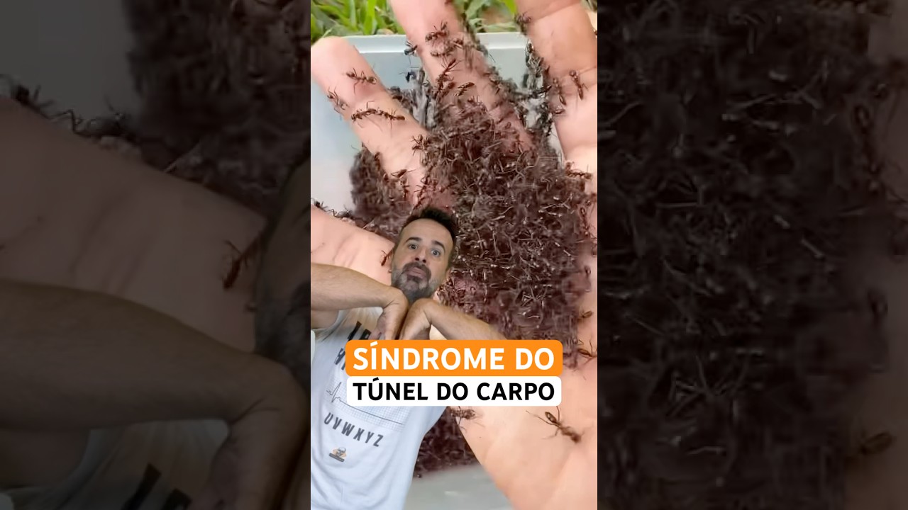 Vc já sentiu dormência, formigamento ou dor no punho e na mão? Pode ser a Síndrome do Túnel do Carpo