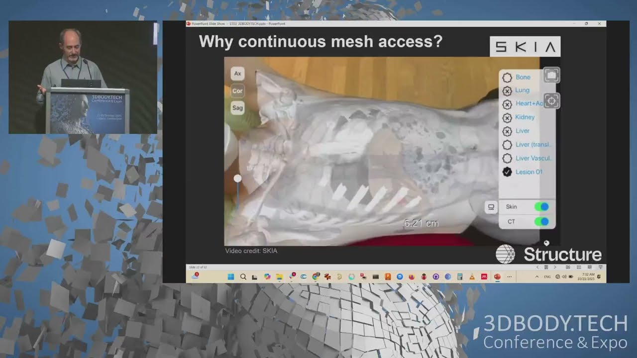 3DBodyTech2025 - Anatomic Scanning Using the Structure Sensor 3 and the Structure SDK