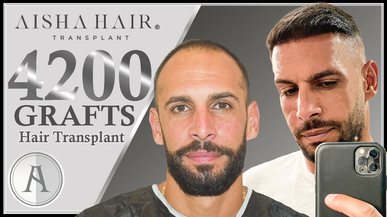 Aisha Hair Transplant Revolution in Turkey | Revolución de Injerto Capilar Aisha Hair en Turquía