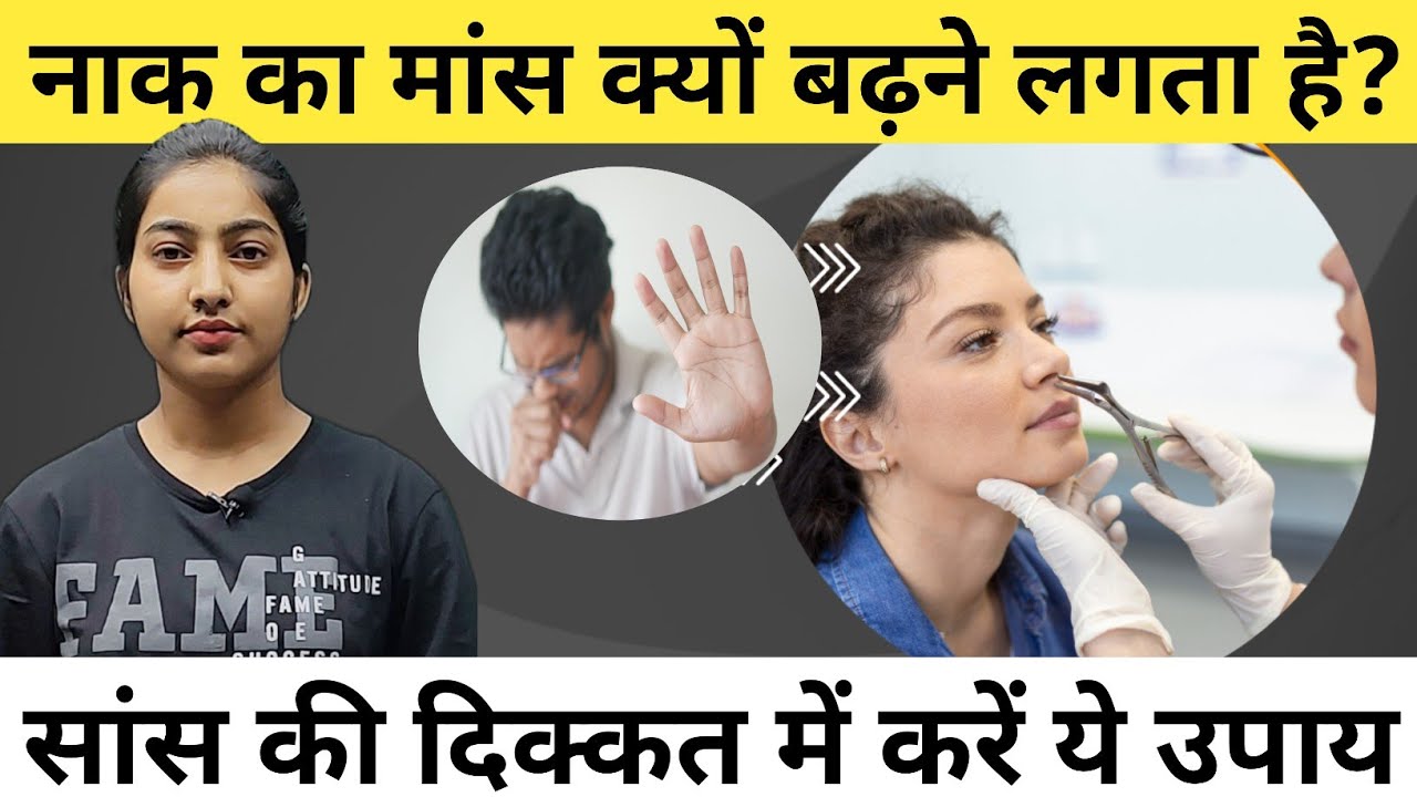 नाक का मांस क्यों बढ़ने लगता है? सांस की दिक्कत में करें ये उपाय|Nasal Polyps in hindi