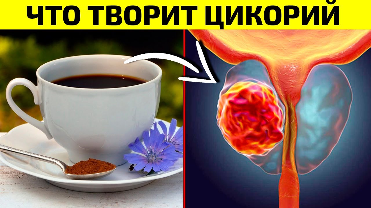Пил ЧАШКУ ЦИКОРИЯ Каждый день и Избавился ОТ МНОГИХ НЕДУГОВ! Цикорий Польза и Вред