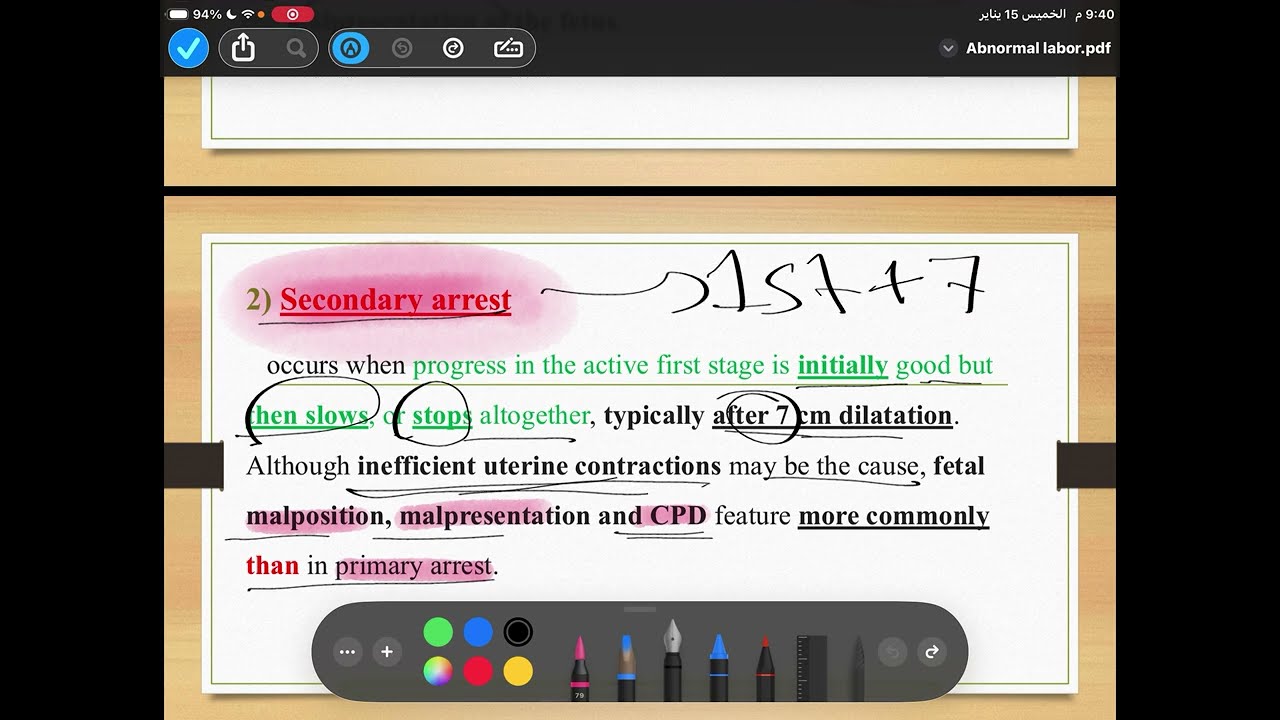 Abnormal labour p1