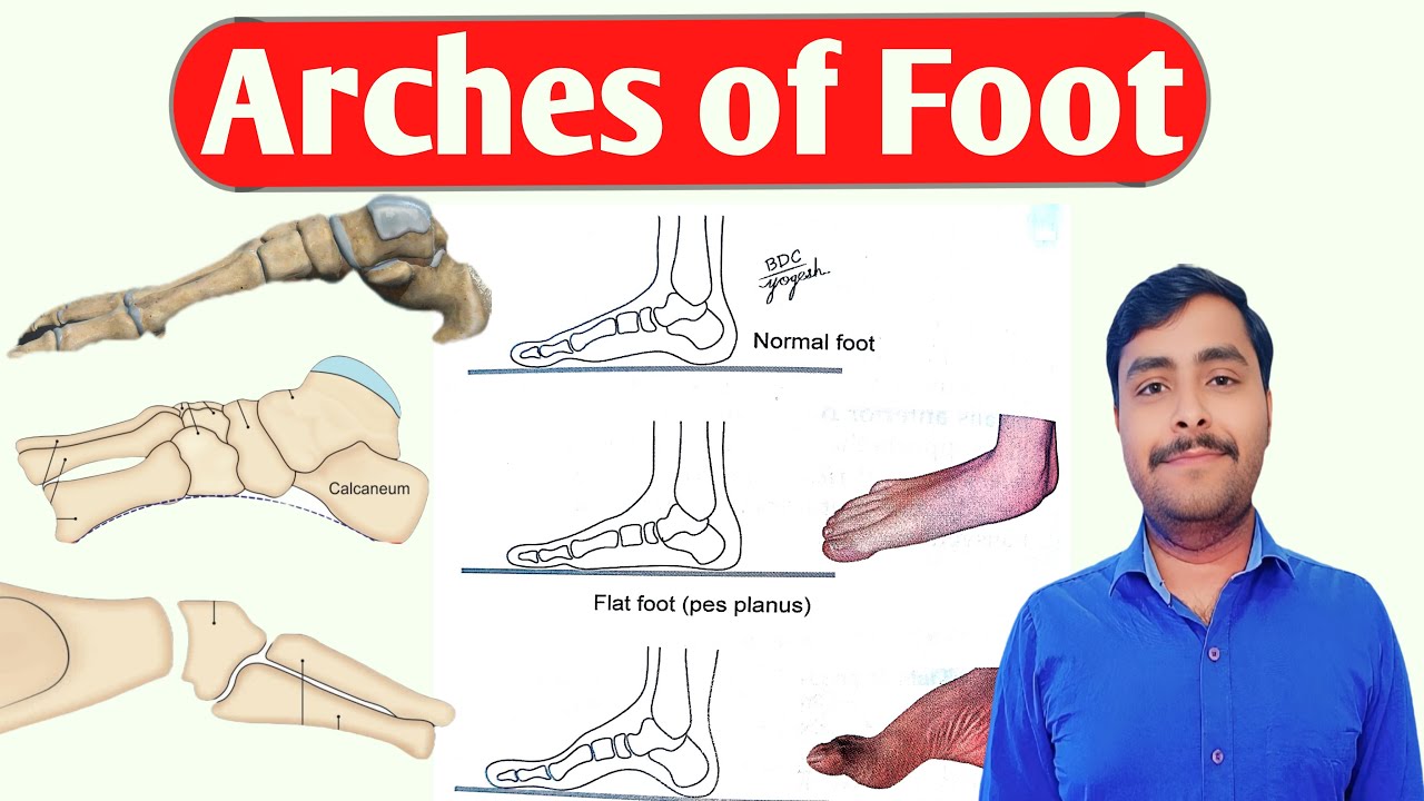 ARCHES OF FOOT I SHASHIKANT KUMAR