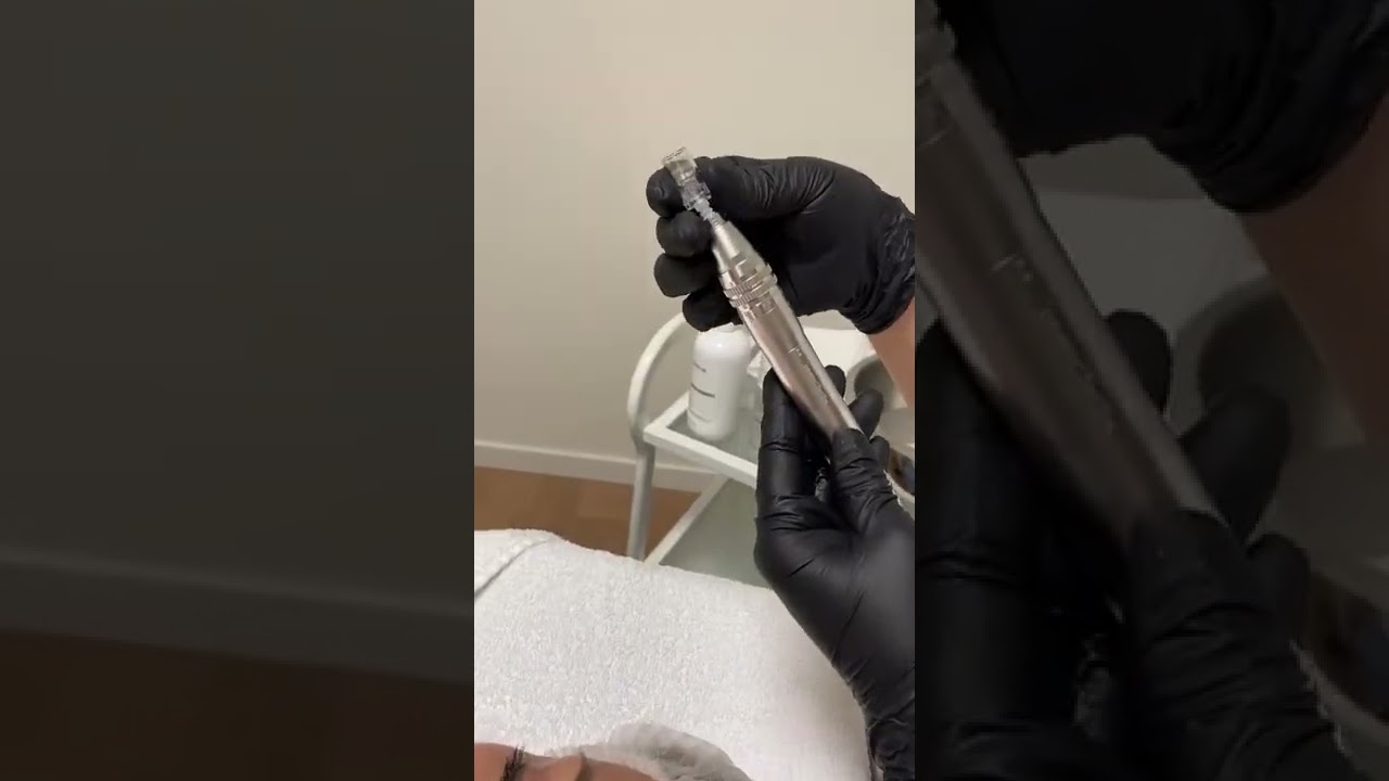 Wat is de Global Eyecon behandeling? 🤩
