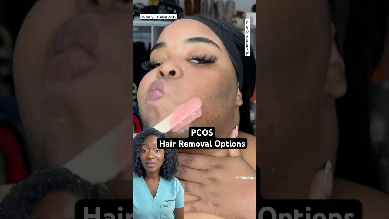 Top Facial Hair Removal Options PCOS | Facial Hirsutism