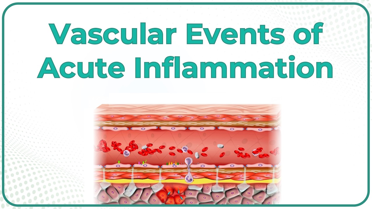 2. Vascular events of Acute Inflammation ( Animation )