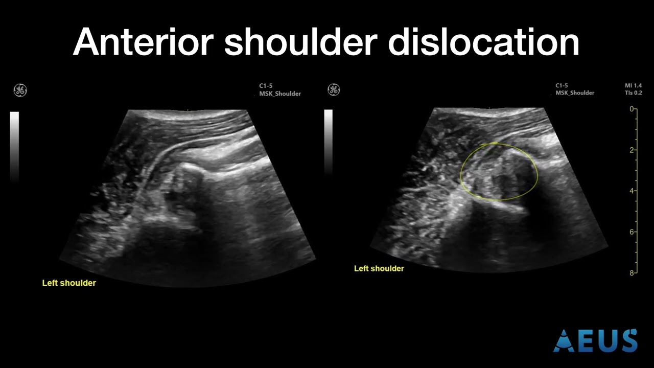 Introduction to Musculoskeletal Ultrasound (MSK)