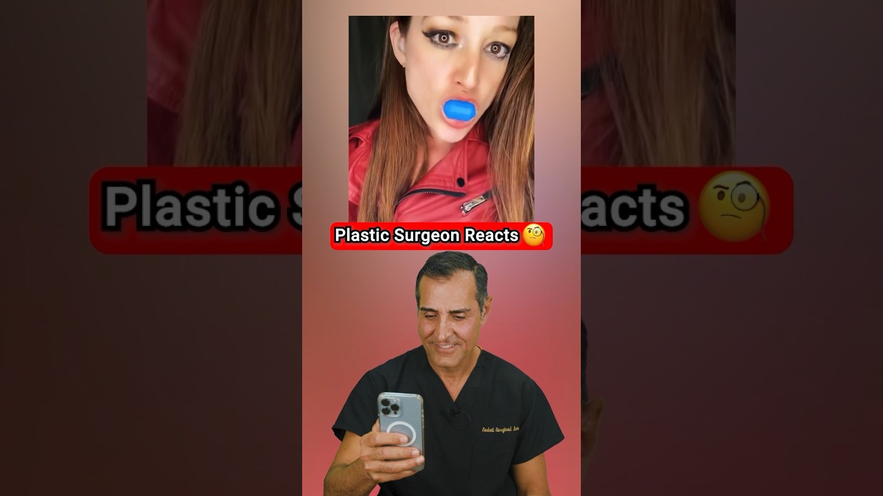 Jawzrsize — Реакция пластического хирурга 