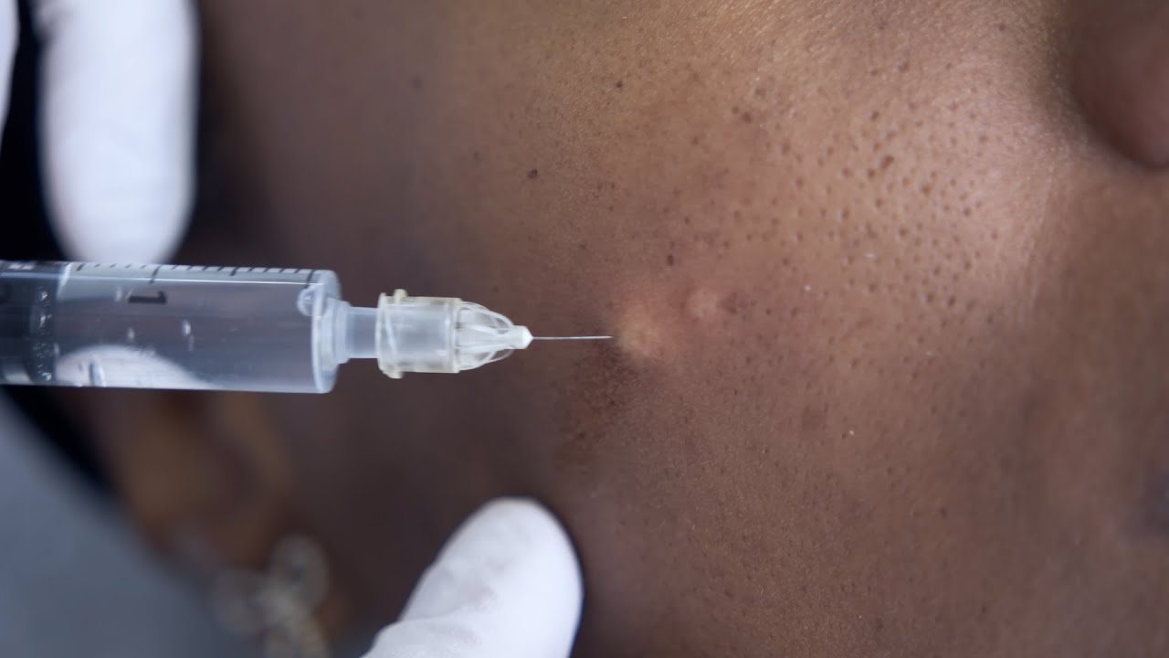 NoTox® & Bio-Botox | Preview unseres Onlinekurses