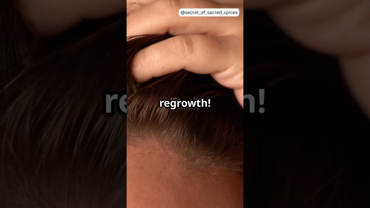 Ginger for Hair Regrowth &ndash; Does It Really Work  🤔🍃#hair #ginger #shortsviral #growth #tips