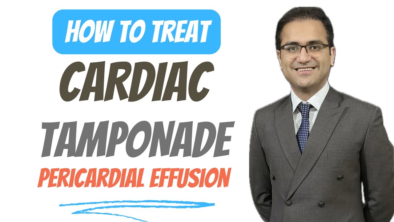 Pericardial Effusion (Cardiac Tamponade) Medicine Lecture on Treatment, Pathology, USMLE NEETPG