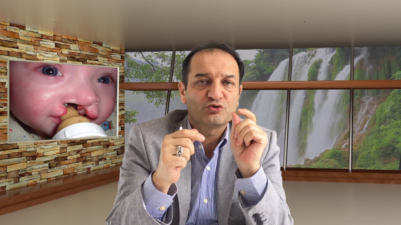 Damak Dudak Yarığında Ameliyat Öncesi Neler Yapılmalıdır? | Damak Yarığı | Prof. Dr. Bekir Atik